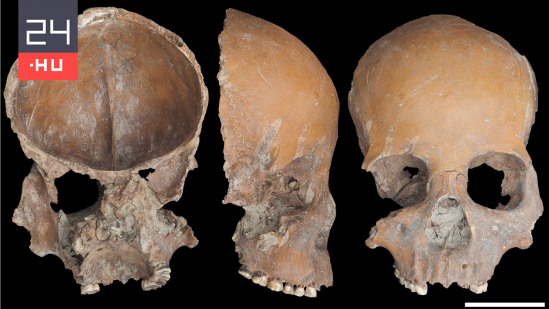 Az újkőkori Kínában a rokonaik koponyáiból különleges poharakat és maszkokat formáltak, ezzel kifejezve tiszteletüket az elhunytak iránt. Ezek a tárgyak nem csupán funkcionálisak voltak, hanem mély szimbolikával is bírtak, reflektálva a közösség hitére és